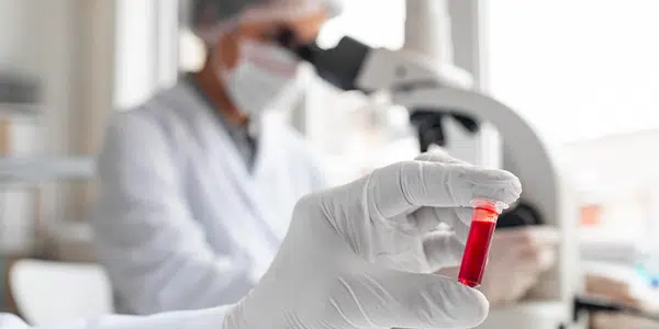 Pesquisadora olha no microscópio ao fundo, com tubo de sangue na frente