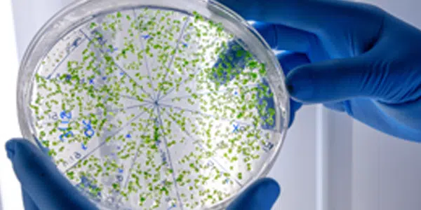 Mãos com luvas azuis seguram lamina com agentes biológicos